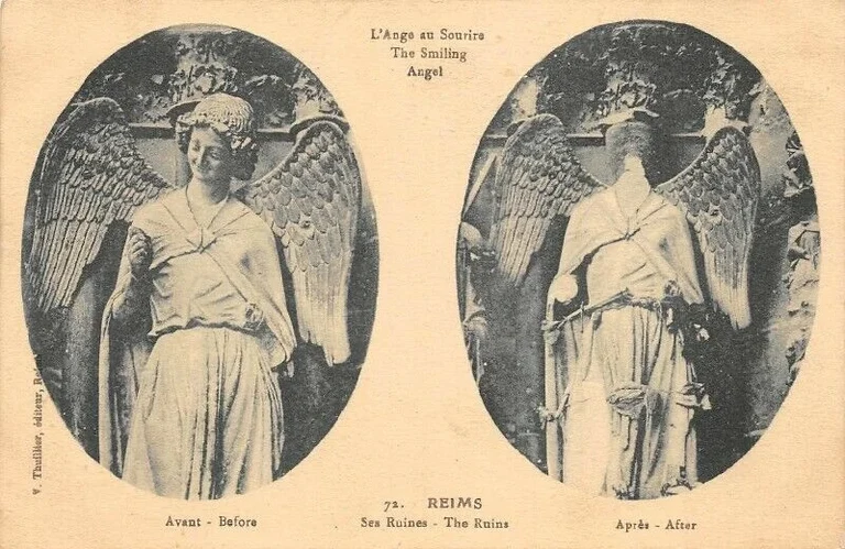 L'Ange au Sourire avant e après.jpg